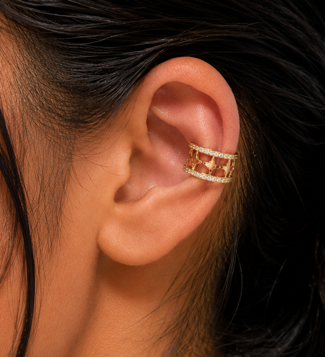 The Stellar Horizon Cuff